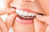 Clear Aligners and Self-Care: Investing in Your Smile