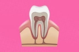 The Importance of Early Intervention in Root Canal Treatment