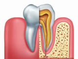 The Role of Antibiotics in Root Canal Treatment