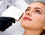 HIFU Treatment Aftercare: Tips for Best Results and Quick Recovery
