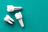 Titanium vs. Zirconia Implants: Which Material Is Better?