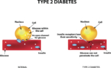 Mitochondrial Dysfunction in Type 2 Diabetes