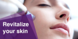 Why Choose Microneedling Treatment in Aventura for Skin Rejuvenation?