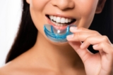 The Importance of Mouthguards in Preventive Dental Care