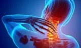 Comparing Pregabalin to Other Treatments for Nerve Pain Relief
