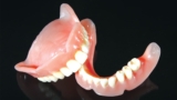 Transitioning from Temporary to Permanent Dentures