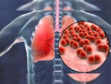 Best Pneumonia Treatment in Mumbai: Expert Care for Quick Recovery