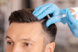 How PRP Can Help with Both Baldness and Thinning Hair
