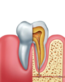 Root Canal Therapy in Cosmetic Dentistry: Enhancing Function and Aesthetics