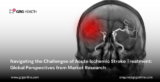 Navigating the Challenges of Acute Ischemic Stroke Treatment: Global Perspectives from Market Research