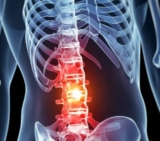 Who Are the Best Spine Surgeons in Mumbai?