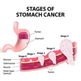 Dr. Ganesh Nagarajan: Liver Cancer Treatment in Mumbai