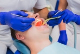 Surgical Teeth Extractions: What to Expect and How to Prepare