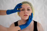 Youthful Contours, No Surgery: DrypSkin’s Thread Lift for Natural Rejuvenation