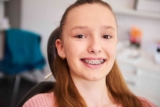What to Expect During Your Braces Journey