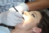 How Can Dental Veneers Help You Smile Bright?