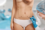 How Long Does Tummy Tuck Surgery Results Last?
