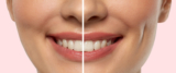 Why Dimple Creation Is Gaining Popularity