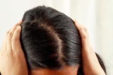 زراعة الشعر للنساء من أجل حياة جديدة
